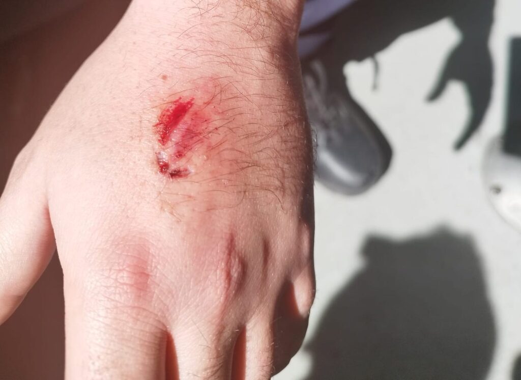 Aggressione Piazza Garibaldi Vasto 14 marzo 2023